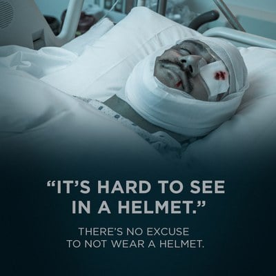 It's hard to see in a helmet. There is no excuse not to wear a helment.
